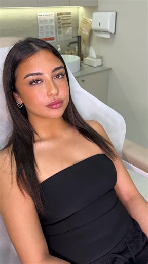 SYDNEY COSMETIC NURSE & BEAUTY on Instagram: "Lips! Lips! Lips! Disclaimer At Diana’s Beauty Lab we provide consultations collagen boosting, tissue regeneration and other facial treatments To book: • Visit dianasbeautylab.com • Book for cosmetic consultation for any cosmetic treatments To find out [how we got these results / how to achieve this look / what products we used / the process] book a cosmetic consultation with our clinic, or contact us via [DM, message, call]. This content is copyrigh