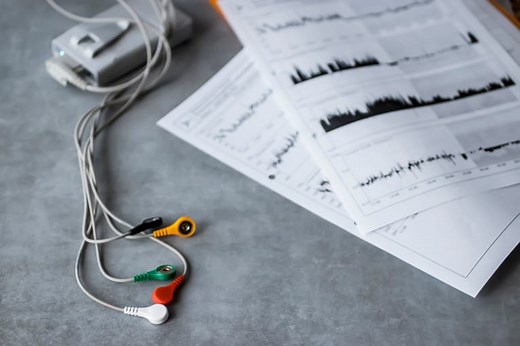 Como interpretar resultados Holter 24 horas: exame normal e anormal