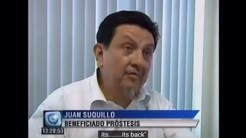 The Bionic Hand That’s Redefining Human Capability