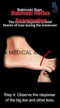 Babinski Reflex Examination | Neurological Clinical Skills Tutorial