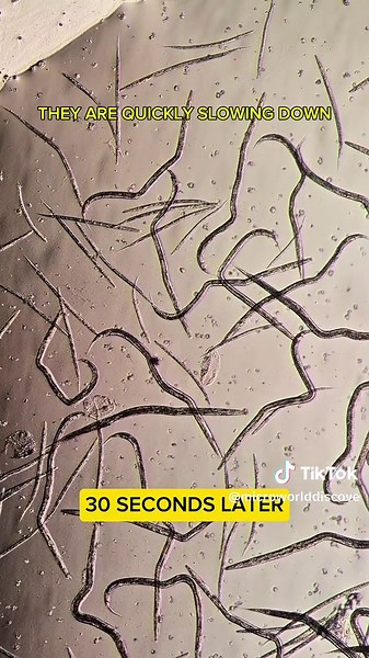 Exploring Parasites Under the Microscope