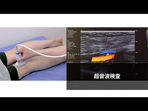 超音波検査（下肢動脈エコー・筋硬度測定）