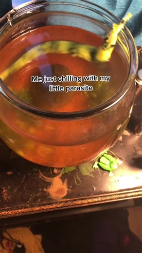 Should’ve thought twice before getting a dark web bed worm parasite 😥 #wormonastring #Wormonastring #WORMONASTRING #WormOnAString #wormonstring #fyp #FYP #foryou #foryoupage #fypシ #livelaughworm #iknowitsfake #hopeyouenjoy