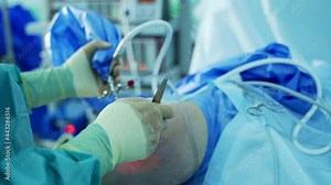 Process of trauma surgery operation. Group of surgeons in operating room with surgery equipment.