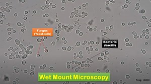 Wet Mount Microscopy: Introduction, Principle, Preparation, Result Interpr