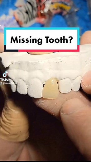 how to make a flipper #ortho #tooth #teeth #fyp #foryou #foryoupage #acrylic @The Bentist / Orthodontist 🦷