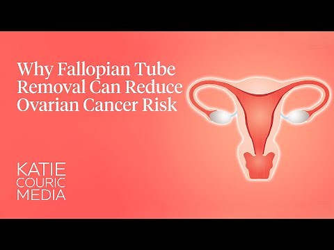 Why fallopian tube removal can reduce cancer risk