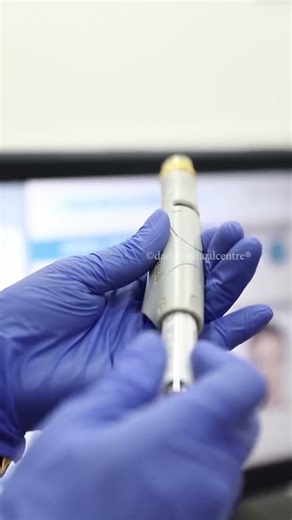 Keravive Exfo Explained | Dermatologist’s Scalp Detox for Hair Health