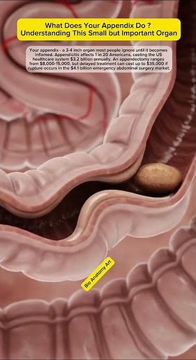 What Does Your Appendix Do? Understanding This Small but Important Organ