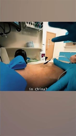 China’s Flying Needle Technique!