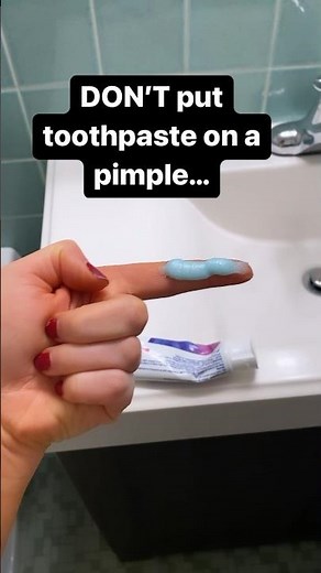 Don't put toothpaste on your pimples!