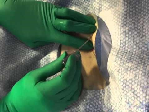 Percutaneous Femoral Access