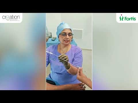 Intrauterine insemination (IUI) explained