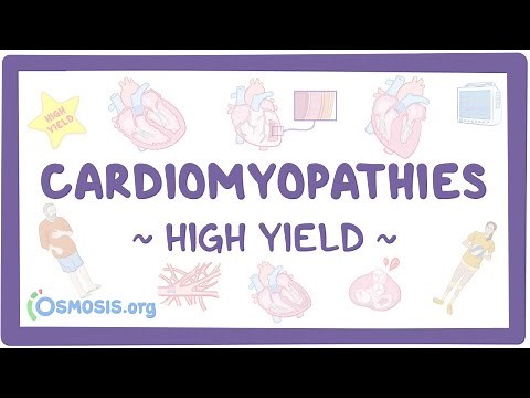 Cardiomyopathies: Pathology review