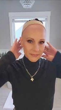 Experiencing hairloss? You're not alone.