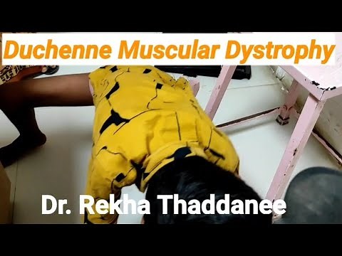 Duchenne Muscular Dystrophy | Pediatrics