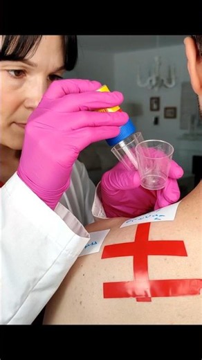 Skin test for potential allergies