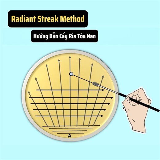 10K views · 95 reactions | Trong video này, chúng ta sẽ cùng tìm hiểu Radiant Streak Method – một kỹ thuật quan trọng giúp phân lập vi sinh vật và tạo ra khuẩn lạc đơn trên đĩa agar. | Dụng cụ thí nghiệm Sinh Học | Facebook