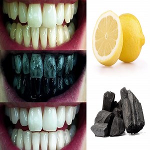 4.9K views · 275 reactions | Activated charcoal in toothpaste may help remove surface stains on your teeth. Charcoal is mildly abrasive and is also able to absorb surface stains to some degree. There is no evidence, though, that it has any effect on stains below a tooth's enamel, or that it has a natural whitening effect. | Health Zone | Facebook