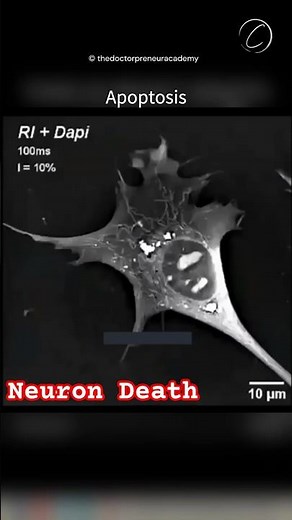 Why Your Cells Self-Destruct #neuroscience #facts #curiousclubtv