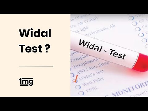 How is Widal Test done for Typhoid Fever? | 1mg