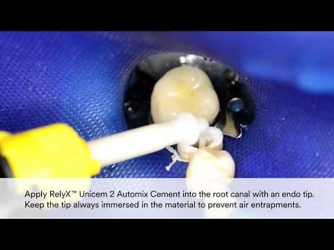 Demonstration of 3M Post and Core Solution Products