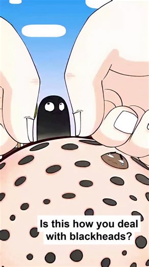 Dr Preeti Mor on Instagram: "@dermatology_diaries - STOP treating blackheads the wrong way! Squeezing, over-scrubbing, or using harsh strips can damage your skin and make things worse. Instead, use salicylic acid, gentle exfoliation, and consistency your pores will thank you! Video 📹- skinubis #blackhead #skincaretips #glowingskin"