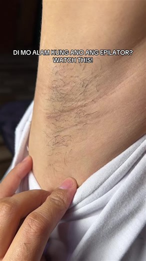 Discover the Benefits of Using an Epilator for Hair Removal