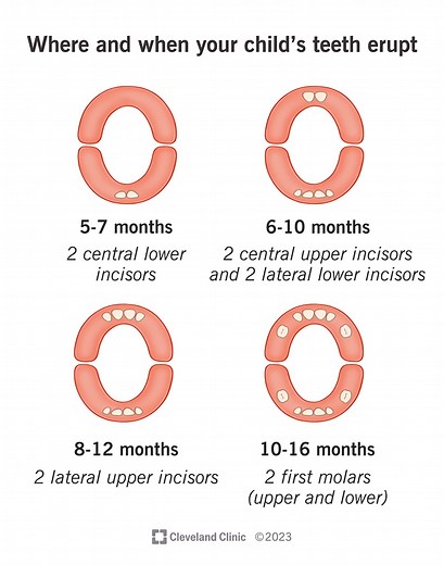Teething (Teething Syndrome)