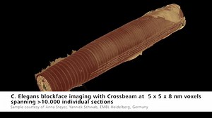 67 reactions · 16 shares | ZEISS light & electron microscopes enable...