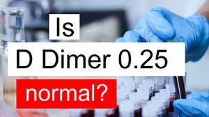Is D Dimer 0.25 normal, high or low? What does D Dimer level 0.25 mean?