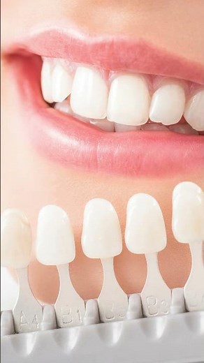 Proper Dental Crown Procedure (5 Useful Aftercare Tips)