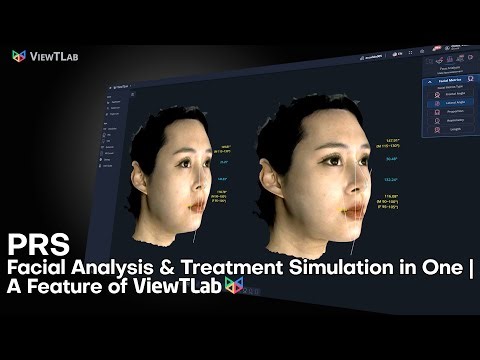 PRS – Facial Analysis & Treatment Simulation in One | A Feature of ViewTLab