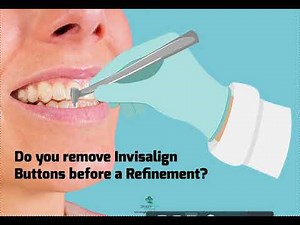 Should Attachments be Removed before Invisalign Refinements?