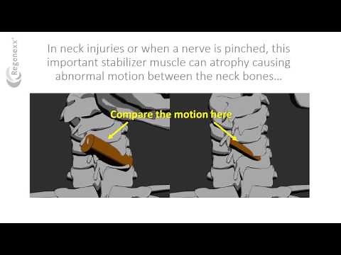 What is the multifidus function?