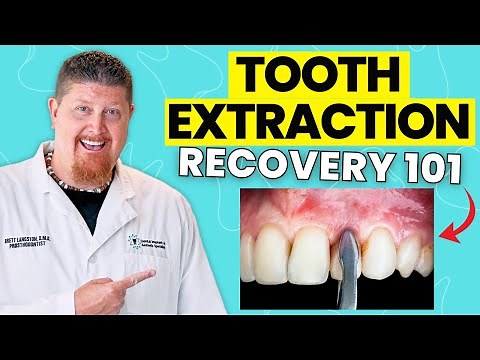 Tooth Extraction Explained: Healing, Aftercare & What Happens Next