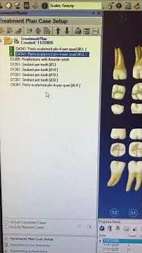 The Most Underrated tool in Dentrix #dentrix #dentaltraining #dentalsoftware #dental #dentistry