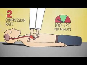 6 Easy Steps of CPR - Animation