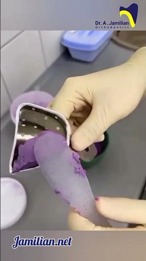 Comprehensive Guide to Taking Alginate Impressions #orthodontics #dentist #impression #alginate