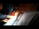 Urethral Sling Surgery with the Monarc Technique • Video • MEDtube.net