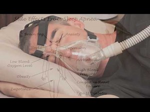 Benefits of CPAP Therapy a