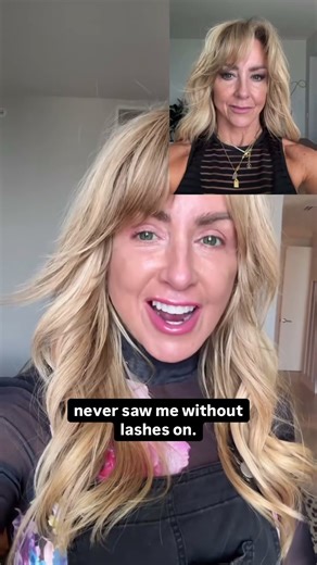 Day 11 Post-Facelift: Eye Reveal + Swelling Update 👀