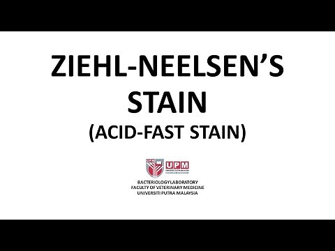 Ziehl Neelsen Stain (Acid-Fast Stain) - Principle, Procedure and Interpretation.