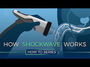 How Shockwave Therapy Works - HOW TO SERIES