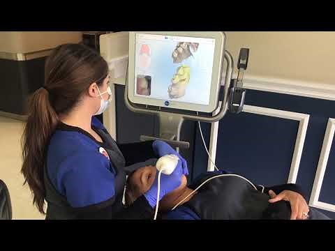 iTero Scan for Invisalign