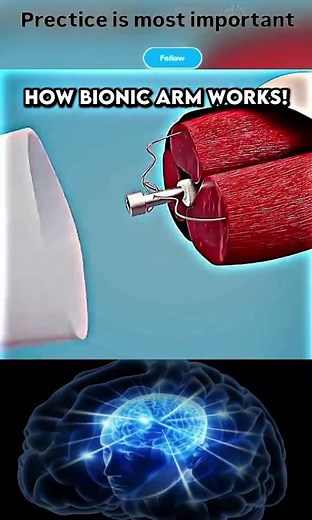 How a Bionic Arm Works – The Science Behind Human-Machine Connection! #trending #foryou #benzadd