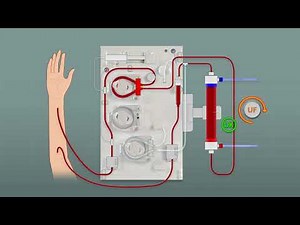 Let’s learn (Surdial X Training Series) - How does the Clean Treatment Start (CTS) work?