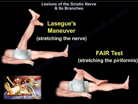 Lesions Of The Sciatic Nerve & Its Branches - Everything You Need To Know - Dr. Nabil Ebraheim