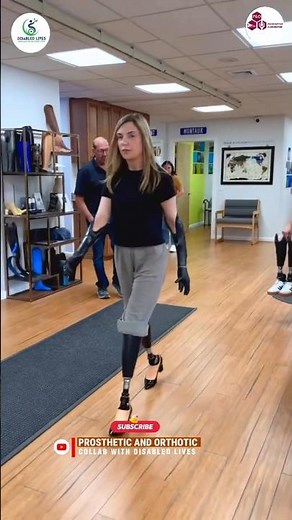 Beautiful Woman with Double Below-Knee Prosthetic Limbs | Gait Training Journey #prostheticjourney
