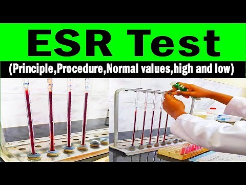 Erythrocyte sedimentation rate | ESR (Principle,Procedure,Normal values,high and low)